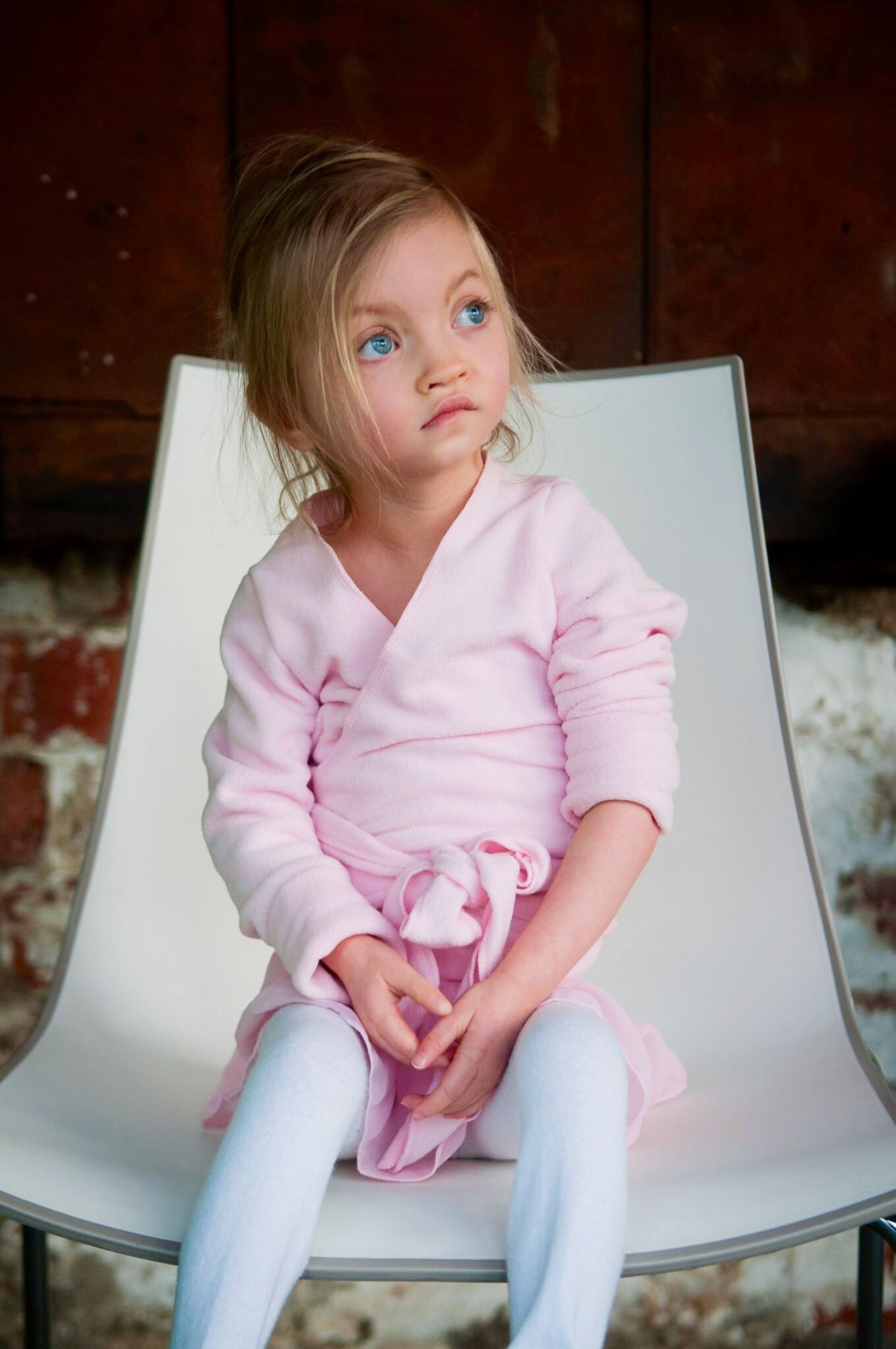 Photo of a child with Wolf–Hirschhorn syndrome