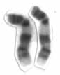 Chromosome 9 cropped