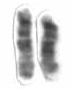 Chromosome 15