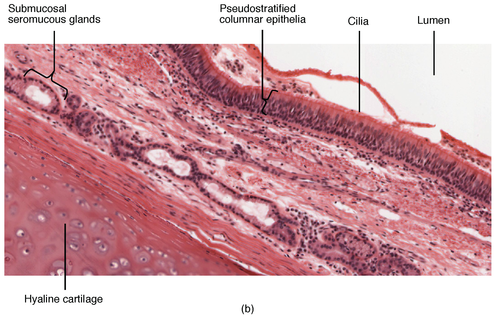 Diagram of the trachea