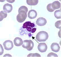 Ehrlichia Ewingii