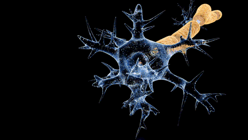 Guillain-Barré syndrome - Nerve Damage