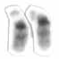 Human male karyotype high resolution - Chromosome 22