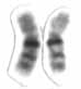 Human male karyotype high resolution - Chromosome 16 cropped