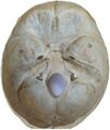 Base of the skull
