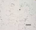 Struvite crystals from a dog with scale