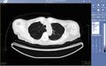 Telehealth