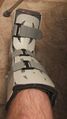 Orthopedic boot