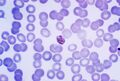 Mature Plasmodium malariae schizont