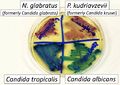 CHROMAgar with N. glabratus, P. kudriavzevii, Candida albicans, and Candida tropicalis
