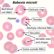 Blood Smear Showing RBCs