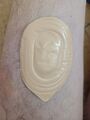Androderm testosterone skin patch