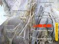 Lumbar nerve anatomy
