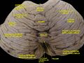 Central lobule