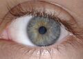 Iris (anatomy)