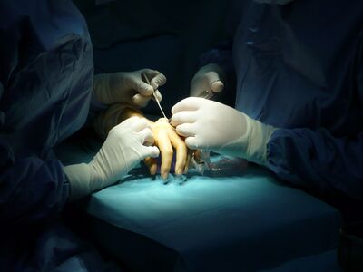 Hand surgery