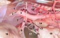 Celiac ganglion location