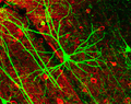 GFP-labeled neuron
