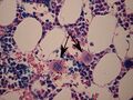 WVSOM Megakaryocytes with arrows