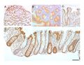 Colonic crypts within four tissue sections