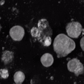 Platelets release in mature megakaryocytes
