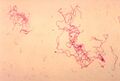 Haemophilus ducreyi