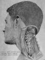 Dissection of the Suboccipital Triangle