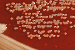 Yersinia enterocolitica