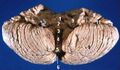 Human cerebellum anterior view description