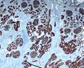 Kidney CD10 IHC