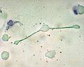 Macrophage engulfing bacteria