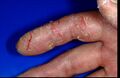 Disfigurement