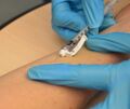 Intradermal injection