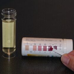 A test strip is compared with a verisimilitude orchestration that indicates the stratum of ketonuria.