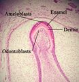 Tooth enamel