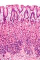 Normal gastric mucosa