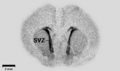 Autoradiography of a brain slice from an embryonal rat