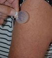 Applying transdermal patch