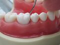 Adaptation of assessment dental explorer F