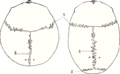 Fibrous_joint