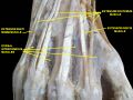 Extensor indicis muscle.