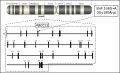 Genetic map of ABCC11