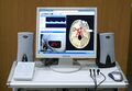 Doppler ultrasound analyzer of blood velocity
