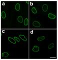 Laminopathic nuclei
