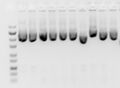 Plasmid miniprep