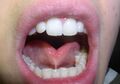 Frenulum linguae