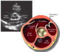 Transthoracic echocardiogram