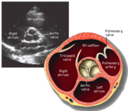 Short axis view of the heart with aortic valve