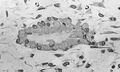 Bony nidus formation 2