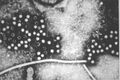 Hepatitis E virus